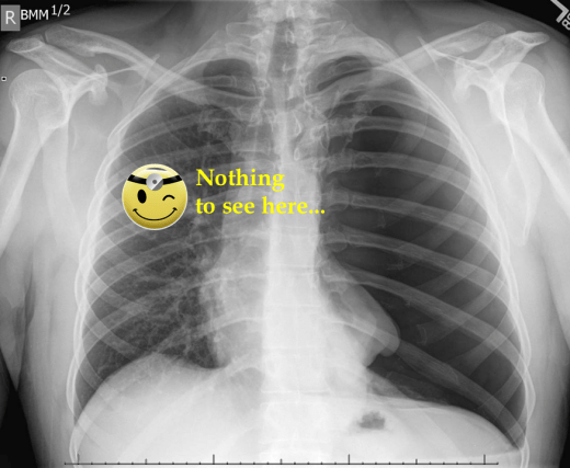 x-ray.png